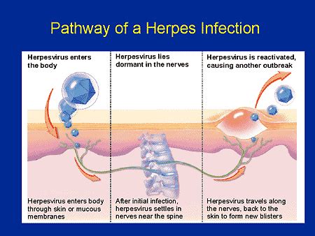 The Diagnosis And Management Of Genital Herpes The Silent Epidemic