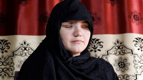 Woman Who Had Eye Gouged Out By Taliban Tells How Terror Group ‘fed