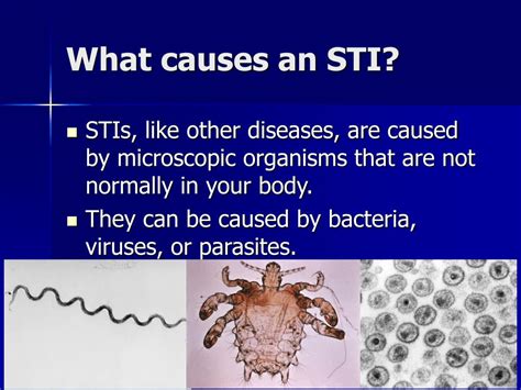 Ppt What You Should Know About Stis Powerpoint Presentation Free