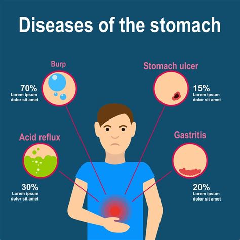 What Causes Ulcers What Cause