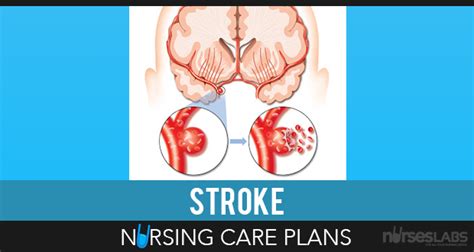 12 Stroke Cerebrovascular Accident Nursing Care Plans Nursing Care