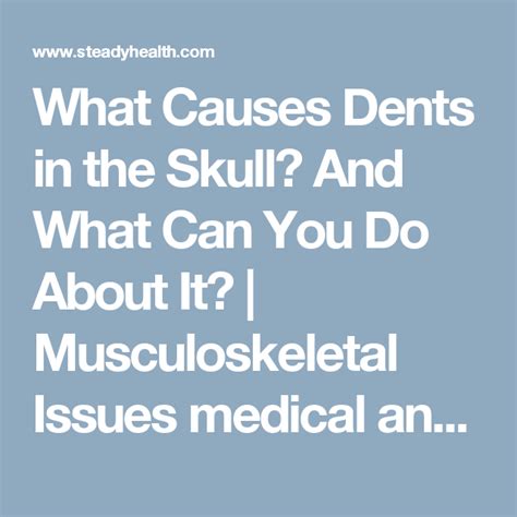 What Causes Dents In The Skull And What Can You Do About It