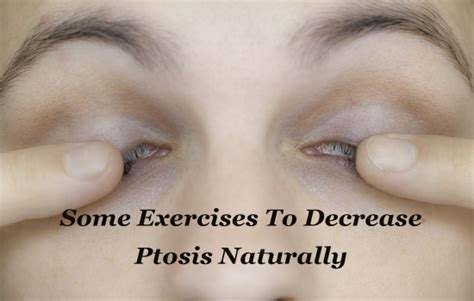 Eye Makeup Tips For Ptosis