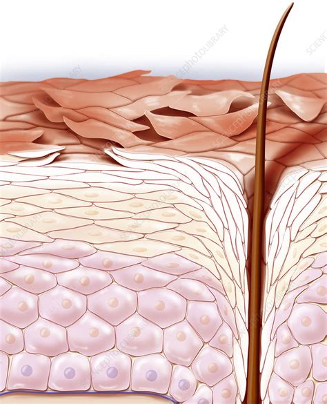 Dry Skin Drawing Stock Image C0209364 Science Photo Library