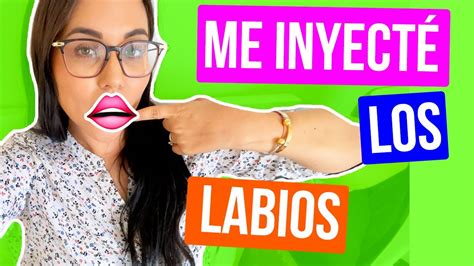 Me Inyecte Los Labios Y AsÍ Quede Karla Celis Vlogs Youtube