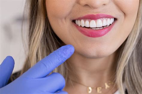 3 Ways Cosmetic Dentistry Can Improve Your Smile Mission Valley