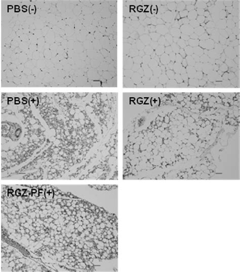 3 Adipocyte Morphology Representative Images Of Hematoxylin And Eosin
