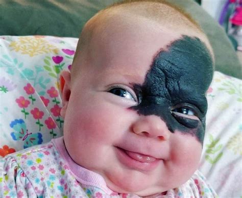 Baby Dubbed Little Superhero Due To Batman Like Birthmark Bbc News