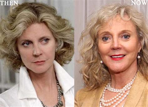 Blythe Danner Plastic Surgery Pic Photo Before And After Celeb