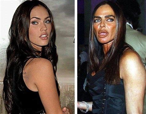 Michaela Romanini Plastic Surgery Before And After Photos Lip Collagen
