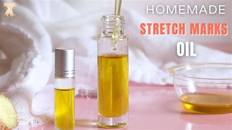 Fade Stretch Marks At Home With This Oil Youtube
