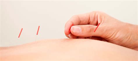 dry needling integrative medicine in austin chiropractor and physical therapy