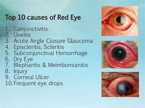 Evaluation Of Red Eye June 2014