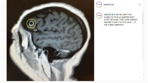 Manfaatnya antara lain membantu meningkatkan stamina dan menyehatkan kulit. Dikira Tumor, Dokter Temukan Cacing Pita di Otak Wanita ...