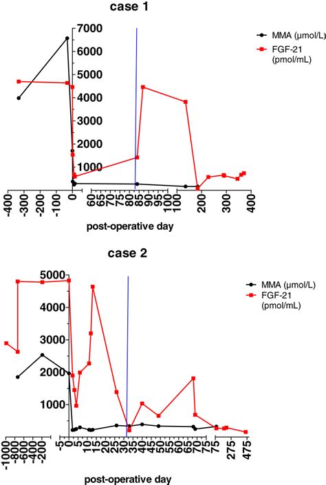 Fgf‐21 And Mma Plasma Level Before And After Transplantation In Case 1