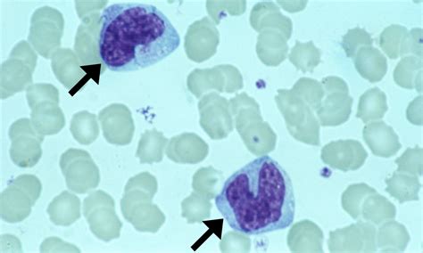 Monocytes Cells And Smears