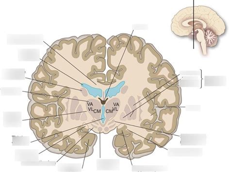 Internal Brain Coronal Cut Diagram Quizlet