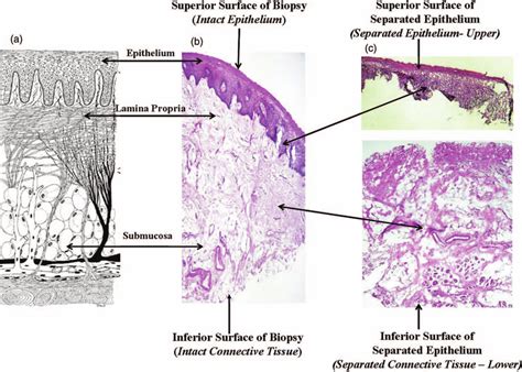 Histological Sections Of Buccal Mucosa A Schematic Representation