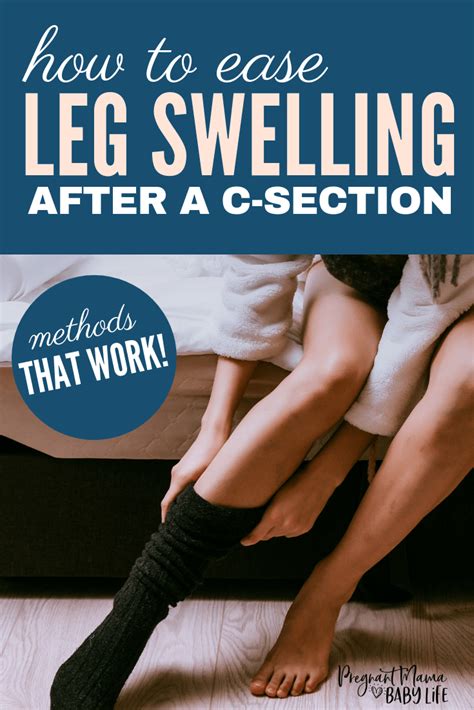 7 Ways To Stop Leg And Feet Swelling After A C Section C Section Post Partum Workout Post