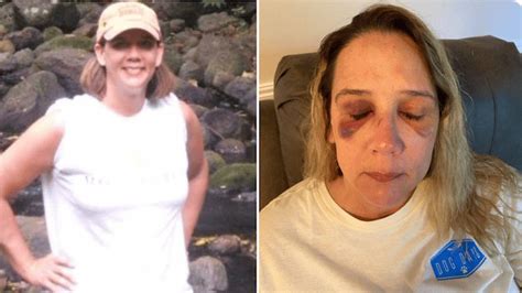 Michelle Audo Missouri Mom Beaten By Teen Girls Trying To Fight Daughter