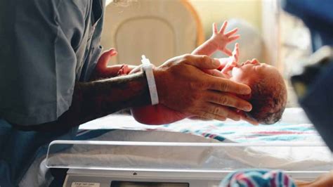 Premature Birth Causes Risky Treatments Host And Care