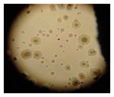 Mycoplasma Colonies With Fried Egg Appearance Download Scientific