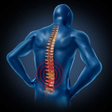 Oriental Medicine And Postural Considerations In Back Pain Tabares