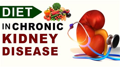 Diet In Chronic Kidney Disease Youtube