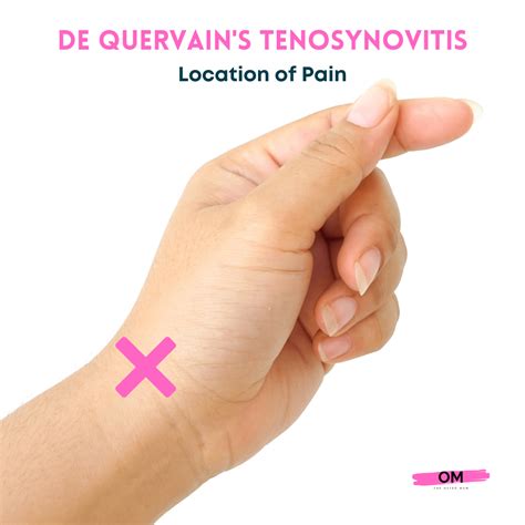 The Best De Quervains Tenosynovitis Brace The Osteo Mum