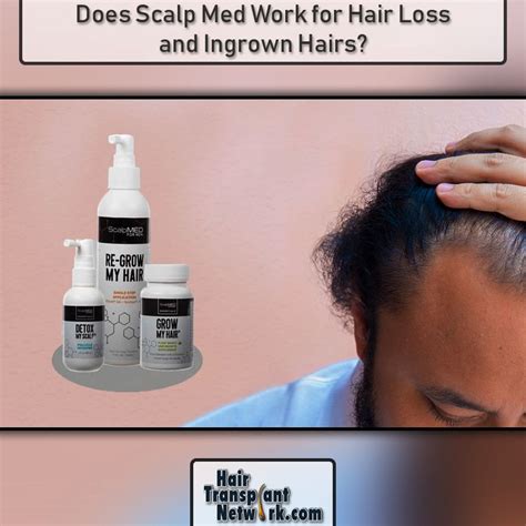 Ingrown hair extraction on scalp. To #find out if #Scalp Med #work as a #multi-purpose # ...
