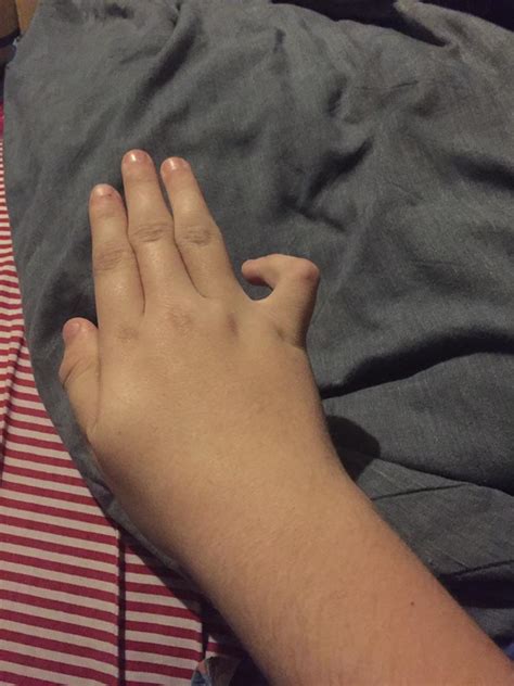 My Pinky Finger R Mildlyinteresting