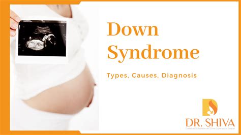 Down Syndrome Types Causes And Treatment Dr Shiva