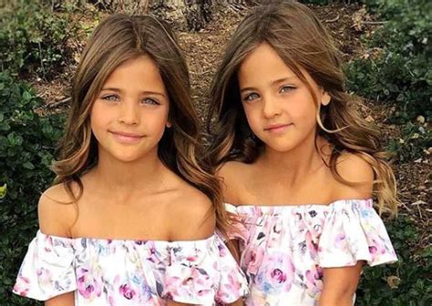 Nine Years Ago They Were Called The Most Beautiful Twins In The World