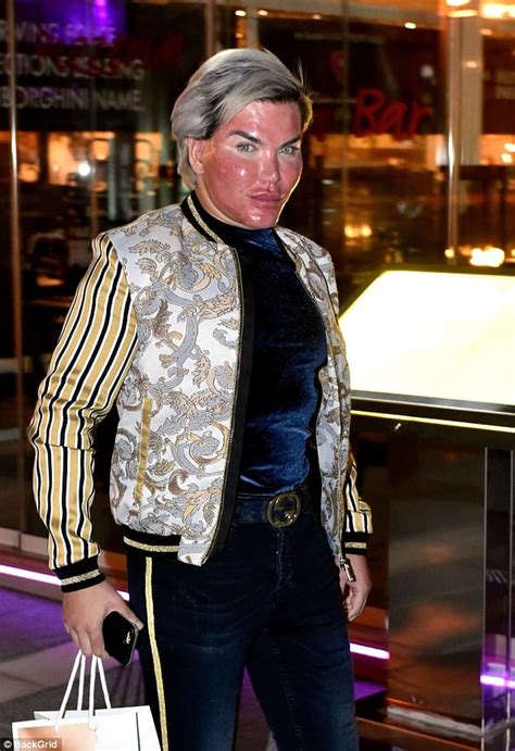 Human Ken Doll Rodrigo Alves Shows Off Chemical Peel Daily Mail Online