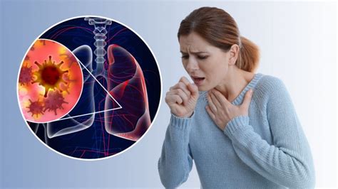 Care Sunt Cele Mai Frecvente Cauze Ale Durerii Pulmonare