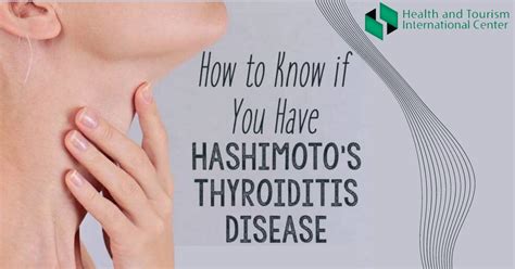 Hashimotos Disease What Causes Immunity To The Thyroid Gland Hti
