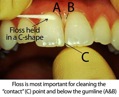 Choosing Dental Floss B And F Dental Clinic Singapore