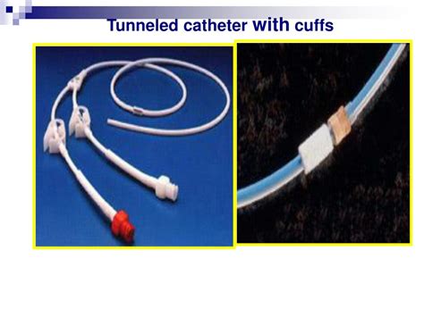 Ppt Iv Terapy And Central Venous Catheters Powerpoint Presentation Id