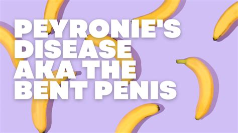 Peyronies Disease Bent Penis Curved Penis Hisential