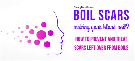 Boil Scars Making Your Blood Boil How To Prevent And Treat Scars Left