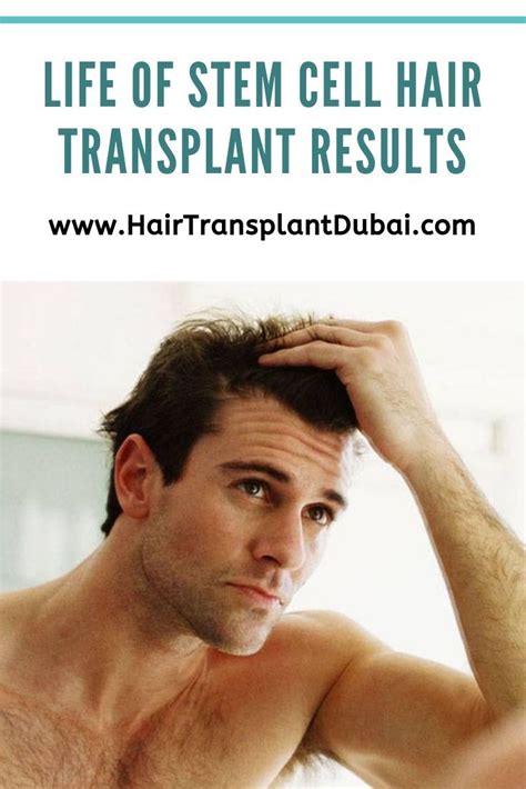 Find out what it is, how stem cells for hair loss work, the benefits they can bring, and much more. FUE Hair Transplant Dubai | Hair transplant, Stem cell ...