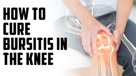 How To Cure Bursitis In The Knee A Episode YouTube