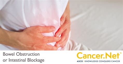 bowel obstruction or intestinal blockage cancer