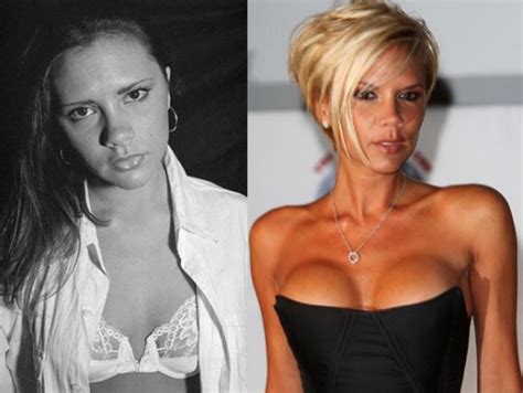 victoria beckham before and after plastic surgery victoria beckham photo 27468245 fanpop