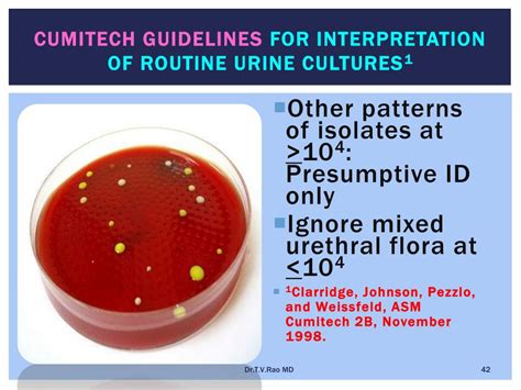 Ppt Culturing Of Urine Powerpoint Presentation Free Download Id111001