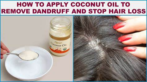 Step by step instructions to Use Coconut Oil For Dandruff