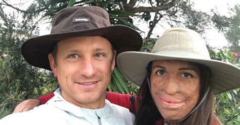 Turia Pitt Shares First Image Of Her Baby Bump While Bonding With A Pregnant African Woman The