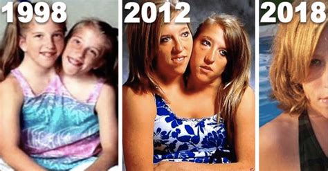 What Conjoined Twins Abby And Brittany Hensel Look 2020 Conjoined
