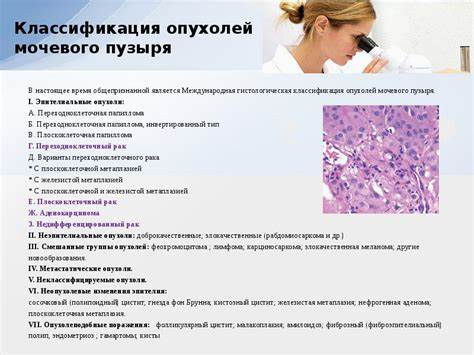 Диета При Раке Мочевого Пузыря У Мужчин — Похудение Диета Правильное Картинка - Диета При Раке Мочевого Пузыря У Мужчин — Похудение Диета Правильное