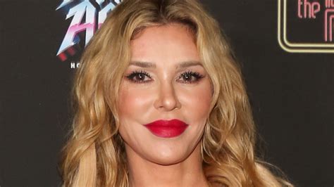 Brandi Glanville Reveals What Really Happened To Her Face